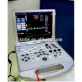 Ultrassom portátil / USG / ultrassonografia médica